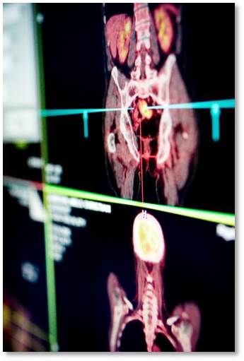 PET imaging